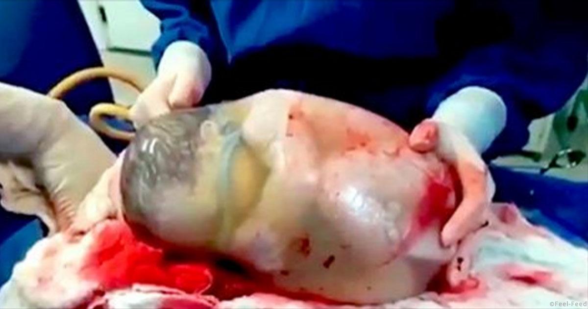 Гель которым вызывают роды Гель которым вызывают роды
