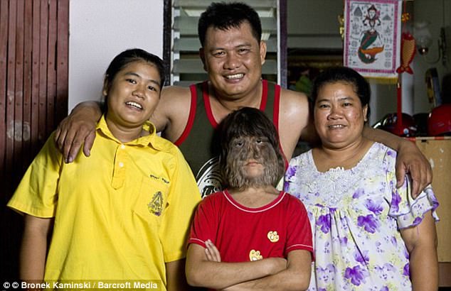 47BF42CE00000578-5234653-Happily_families_Ms_Susuphan_aged_12_with_her_sister_Sukanya_lef-m-9_1515059510272